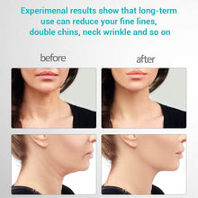 Load image into Gallery viewer, PureLift™ - Skin Rejuvenating Device